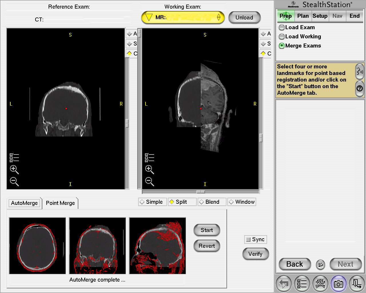 Cranioplastica new MAGAZINE