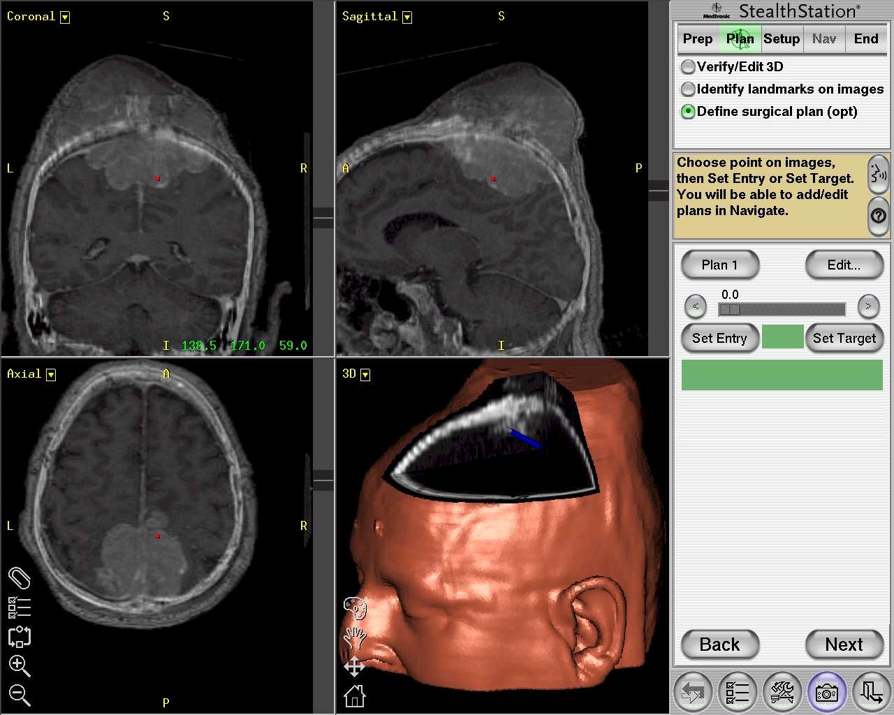 Cranioplastica new MAGAZINE